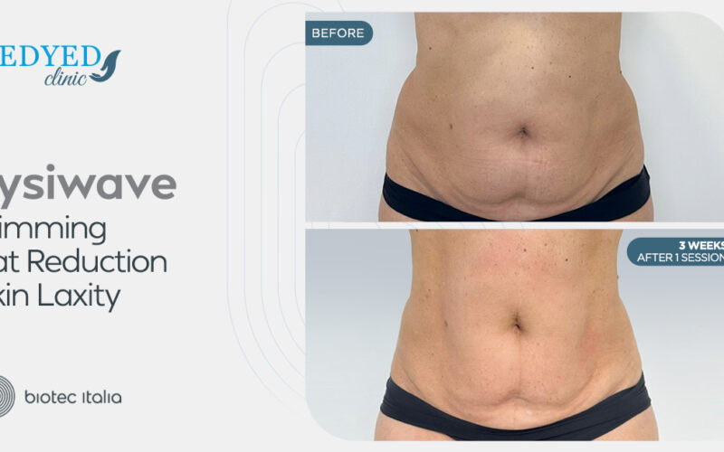عيادة Medyed تجربة شاملة للعلاجات التجميلية والعافية المتقدمة